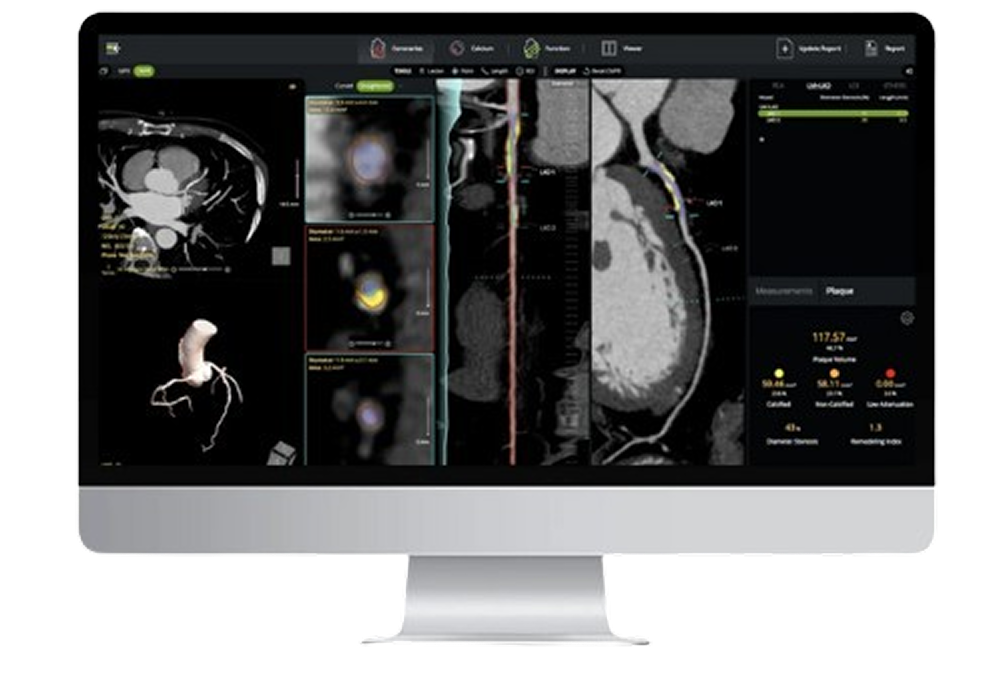 Monitoring Screen